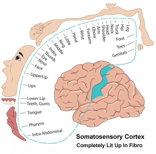 Diagram of the somatosensory cortex to show area that is completely lit up by the TSPO marker that maps fibromyalgia pain.